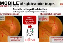 Fujitsu presenta una solución de IA para detectar la primera causa de ceguera