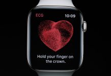 ECG de Apple Watch salva la vida a un usuario escéptico ECG de Apple Watch salva la vida a un usuario